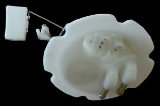 NISSAN SUNNY- B13- 90/94; YAKIT DEPO SAMANDIRASI (ENJEKSIYONLU TIP) (TW)